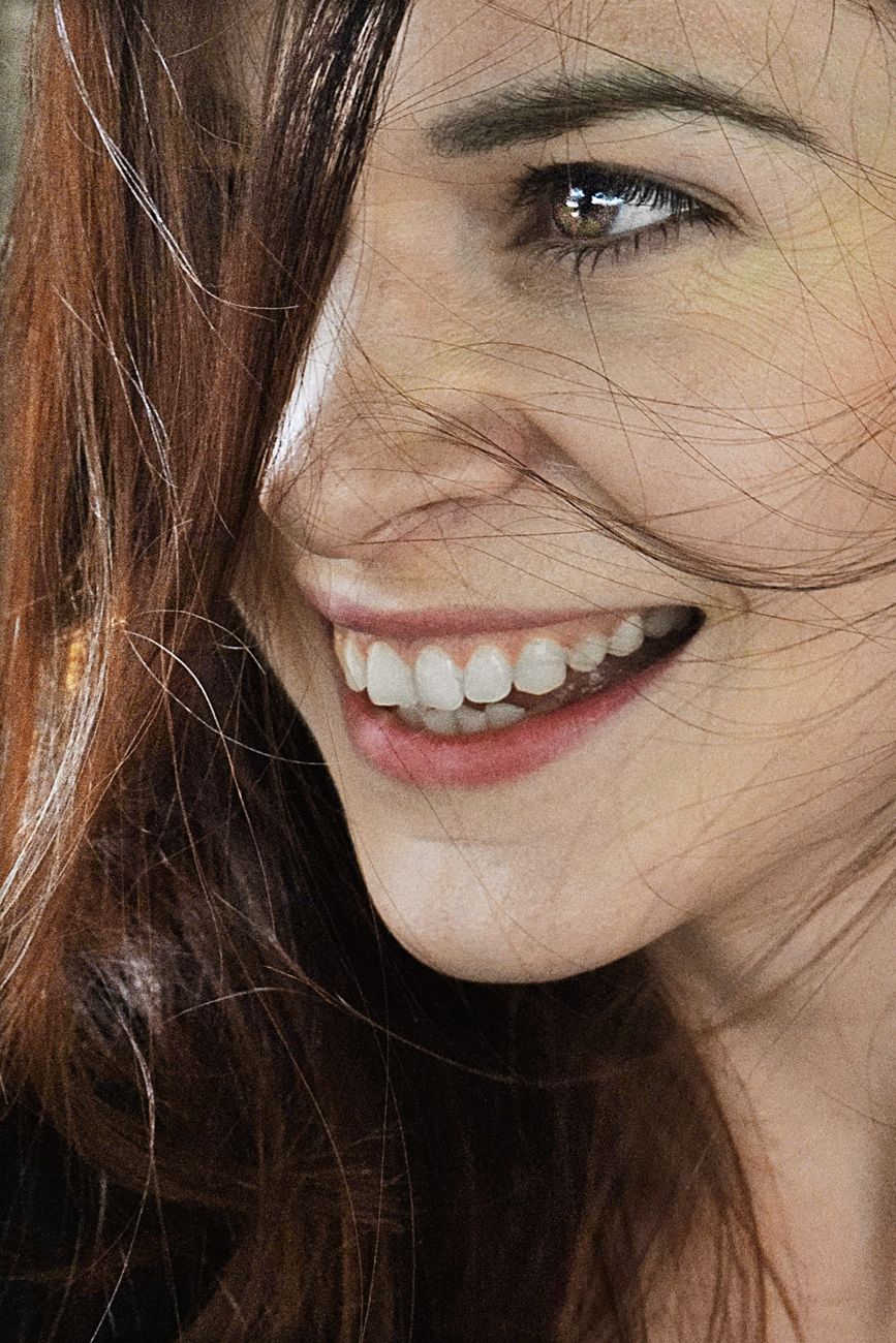 Veneers